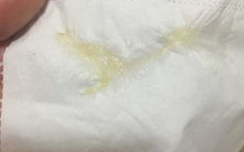 女生下面流出的白色液体是什么,揭秘白带之谜